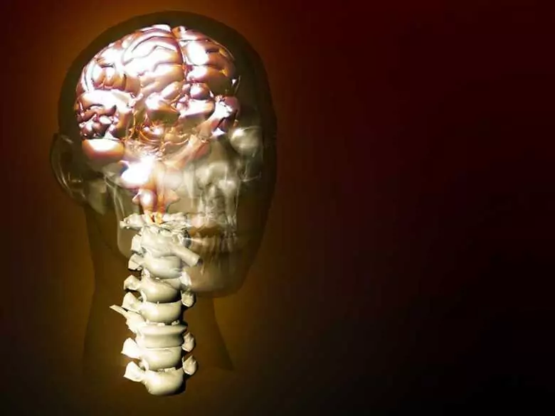 Padaczka  u dzieci – zespół Westa