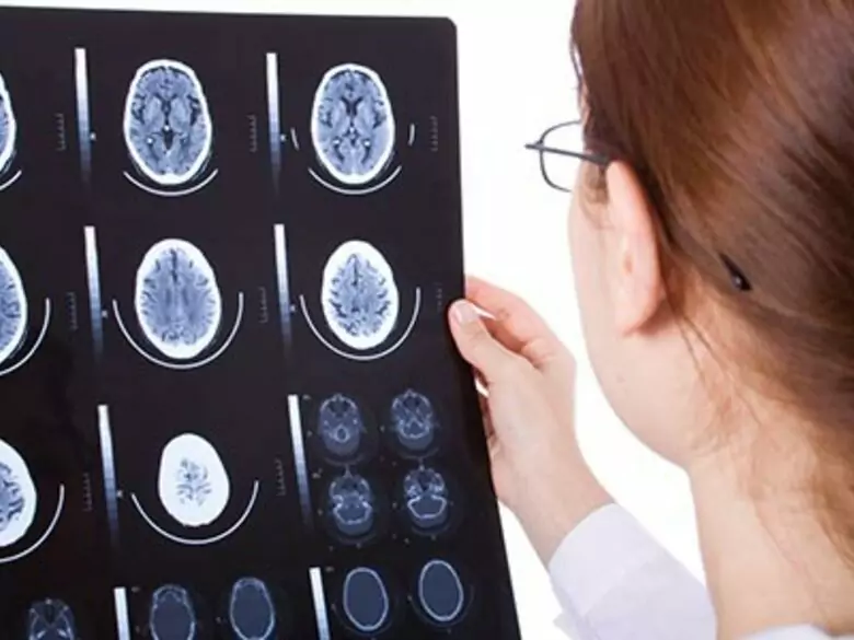 Dzięki MRI można wykryć dysleksje u dzieci