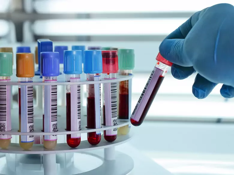 Niedokrwistości spowodowane utratą krwi