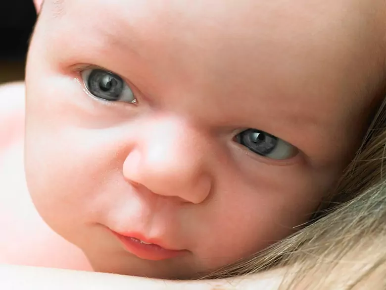 Mózgowe porażenie dziecięce