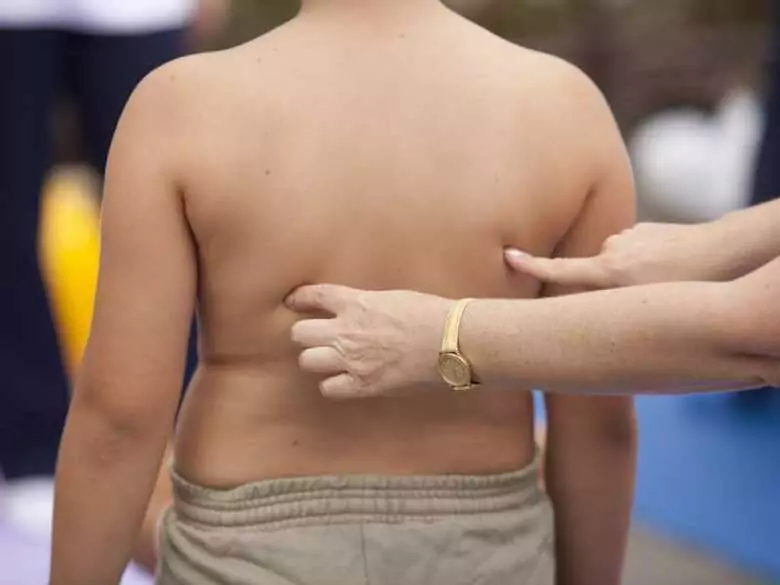 Miażdżyca i zawał serca u dzieci - czy to jest możliwe?